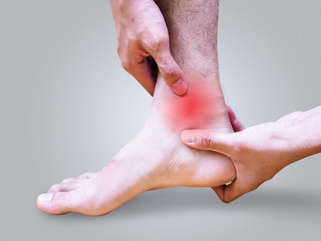 Ankle Sprains – Do You Need to See a Physiotherapist?