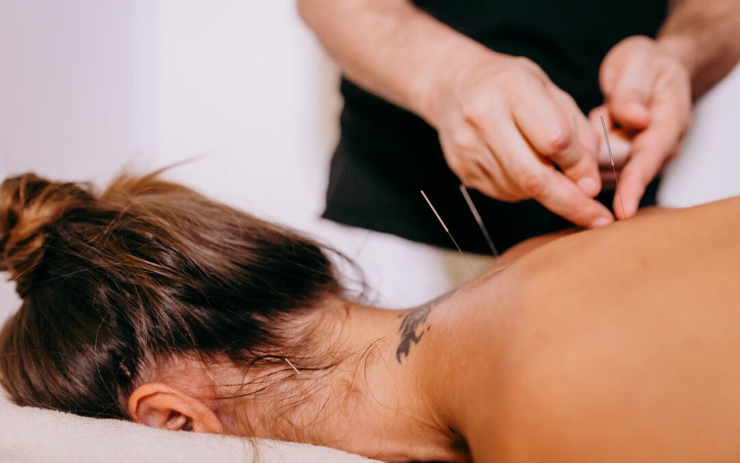 The Benefits of Acupuncture: Relieving Pain and Improving Health Naturally