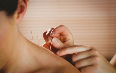 How Does Acupuncture Affect the Body?