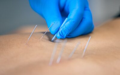Can Acupuncture Help With Chronic Pain?