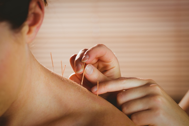 Acupuncture Oshawa: What It Helps & Your First Visit Guide